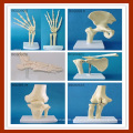 Knie Anatomische Simulation Knie Gelenk Skelett Modell für medizinische Lehre